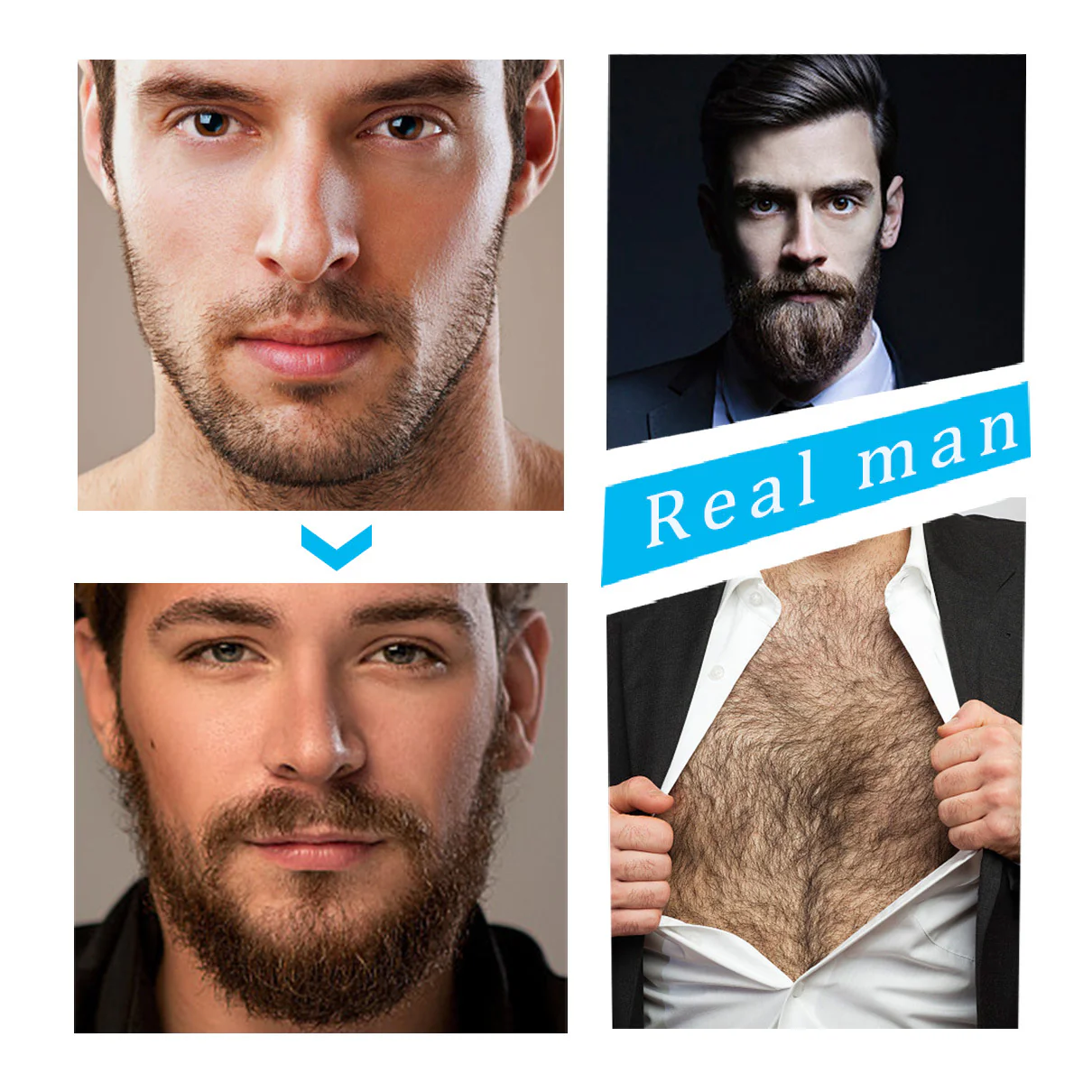 VVS Beard Growth Kit - Image 5